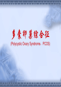 多囊卵巢综合征