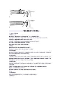 输尿管镜技术(秘笈版)