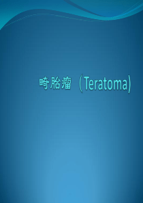 畸胎瘤