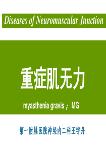重症肌无力简介PPT