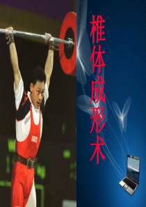椎体成形术