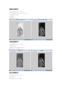 matlab完成分段函数的灰度变换