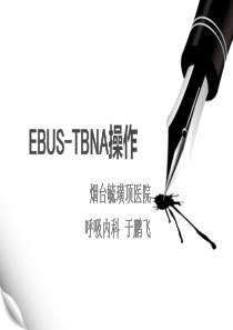 EBUS-TBNA操作流程