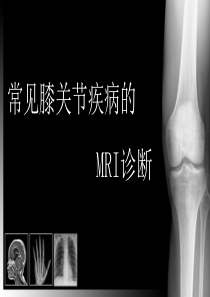 膝关节MRI
