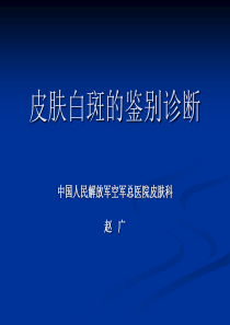 皮肤白斑的鉴别诊断