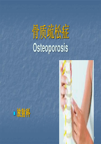 骨质疏松症ppt