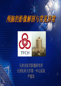 颅脑的影像解剖与常见异常.