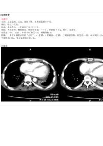 肝脏病变讨论