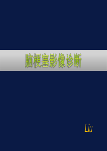 脑梗塞MR总结.