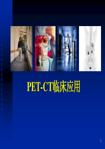 脑部PET的临床应用.