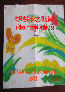 类风湿关节炎的规范诊治.