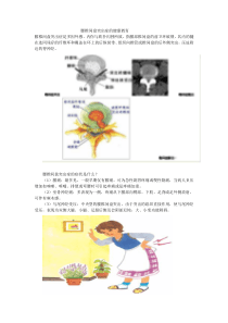 腰椎间盘突出症的健康教育1