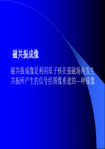 磁共振成像(MRI).