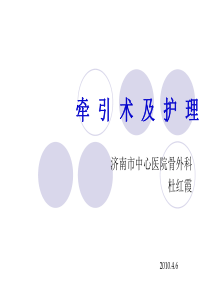 牵引术及护理.