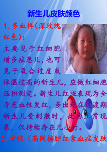 新生儿皮肤颜色妇产科宣传栏图片