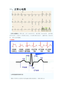 心电图知识