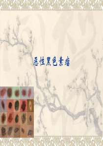 恶性黑色素瘤讲1稿.