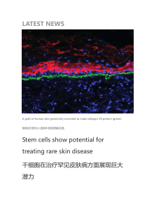 干细胞治皮肤病