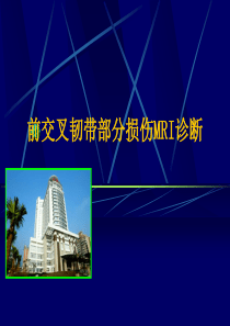 前交叉韧带部分损伤MRI诊断