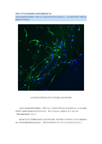 剑桥大学开发皮肤细胞生成神经细胞的新方法