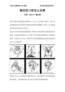 侧切伤口痒怎么回事