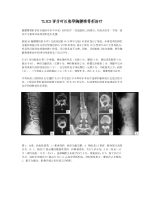 TLICS评分可以指导胸腰椎骨折治疗