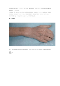 23个骨科常见体征你都认识吗