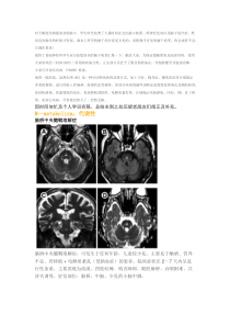 30张图理清脑干病变(代谢炎症篇)