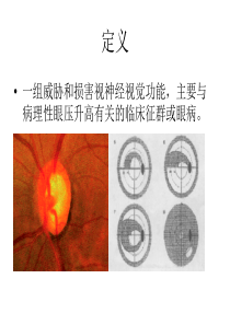 61青光眼