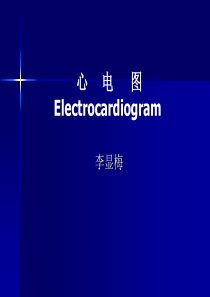 快速看懂心电图