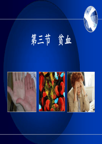 38贫血