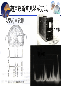 超声影像学(多普勒血流显像)
