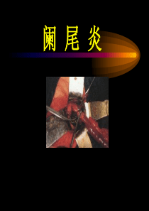 第三十九章阑尾炎 学习要求