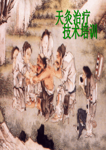 天灸
