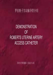 Robert子宫动脉导管