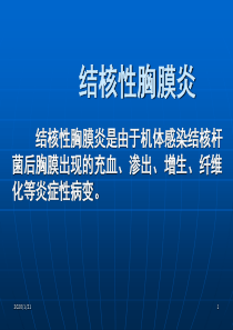 结核性胸膜炎