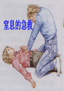 窒息的急救