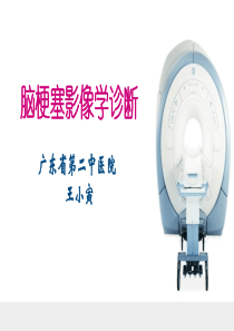 脑梗塞的影像学诊断