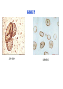 体液常规