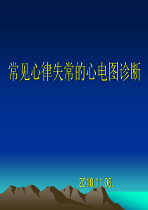 常见心律失常的心电图诊断