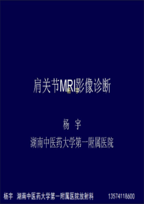 肩关节MR解剖病变0012