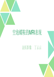 空泡蝶鞍的MRI表现