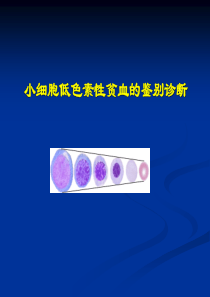 小细胞低色素性贫血的鉴别诊断