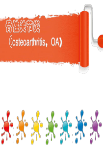 50骨性关节炎