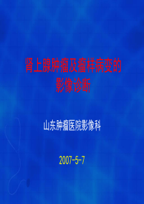 肾上腺肿瘤的影像诊断