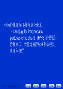 经颈静脉肝内门-体静脉分流术
