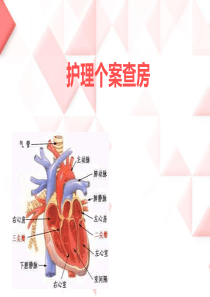 急性心肌梗死护理个案查房东九