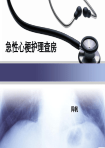 急性心肌梗死护理查房