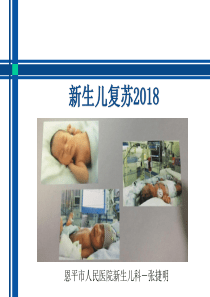 新生儿复苏2018