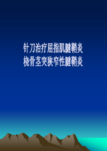 小针刀治疗腱鞘炎